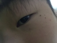 私は目の横幅が2 5cm縦が１cmしかありません やはり小さいですよね Yahoo 知恵袋