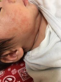 赤ちゃんの保湿として使いたいのですが 馬油 ソンバーユ Yahoo 知恵袋