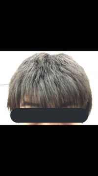 このように髪型がヘルメットみたいなのですが原因なんですかね Yahoo 知恵袋