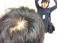 最近短髪にしました 光の真下からとったたら頭皮がすけてますこれって Yahoo 知恵袋