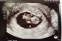 性別について 現在妊娠12週です 10週の時にもらったエコーの写真なのです Yahoo 知恵袋