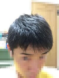 男性で メガネをするときにもみあげが潰れて変な跡が残るのはどう Yahoo 知恵袋