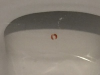 新築のトイレの水の中に 1センチ程の虫が2匹いるのを見つけました この虫は何でし 教えて 住まいの先生 Yahoo 不動産