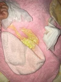 生後9日の新生児なのですが 授乳後嘔吐したのですが 黄色い気がします 母 Yahoo 知恵袋