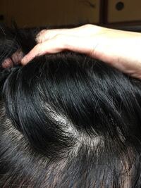 最近抜け毛予防にサクセス育毛トニック使っていたんですが 抜け毛が以前より増 Yahoo 知恵袋