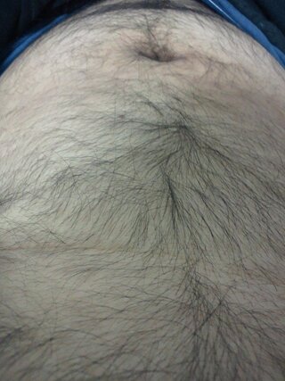 腹毛やばいですか 剃ったりした方がいいですかね ご自由にどうぞ です Yahoo 知恵袋