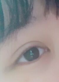 みんなに整形を疑われます 目の二重整形をしてると学校中に噂 Yahoo 知恵袋