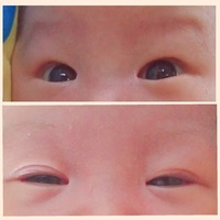 赤ちゃんのまぶたについて生後二週間の赤ちゃんがいます 産まれた時 切れ Yahoo 知恵袋