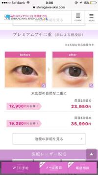 6年間アイプチや絆創膏などで二重を作ってきてもクセがつかず品川スキンクリニ Yahoo 知恵袋