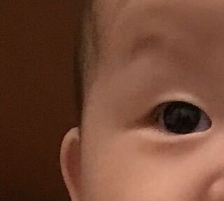 生後6ヶ月の娘です これは二重になっていく目元ですか 生まれてすぐ Yahoo 知恵袋 生後6ヶ月の娘です これは二重になっていく目元ですか 生まれてすぐ Yahoo 知恵袋