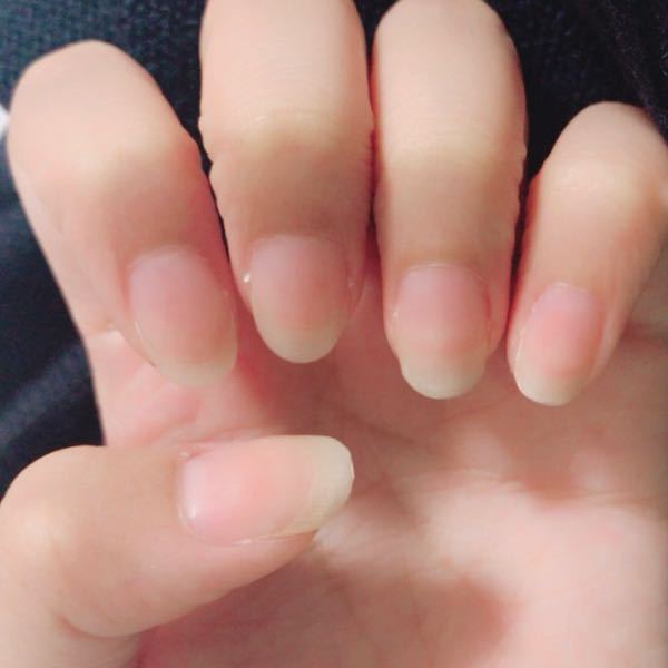 人生 爪 白い 部分 多い