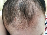 赤ちゃんの頭を掻くのをやめさせたいのですが 生後６ヶ月 Yahoo 知恵袋