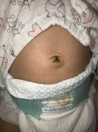 生後１ヶ月の赤ちゃんのおへそについて 乾いたゴマみたいなの Yahoo 知恵袋