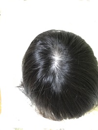 これは髪の毛が薄い方になるのでしょうか 代後半の女です 今 Yahoo 知恵袋