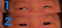モロー反射がひどくすぐに泣いて起きてしまう１ヶ月の赤ちゃん どうしたらよいで Yahoo 知恵袋