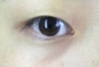 一重まぶたがコンプレックスでできるのであれば自力で二重まぶたにし Yahoo 知恵袋