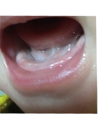 生後７ヶ月の子供に歯が生えてきました 左下の前歯一本だけです Yahoo 知恵袋