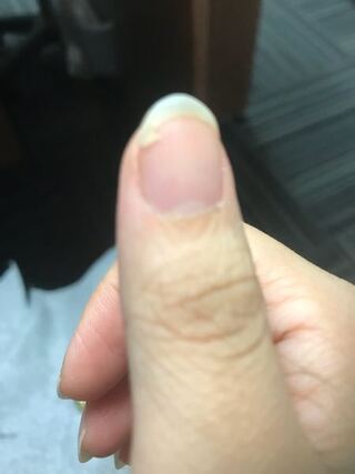 爪が割れたのですが切るべきですか そのままトップコートなどで保護すれば繋が Yahoo 知恵袋