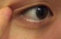 まぶたの脂肪を落とすには どういうマッサージがいいでしょうか Yahoo 知恵袋