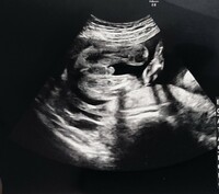 妊娠24週の時のエコー写真です 今はもう30週なのですが そろそ Yahoo 知恵袋