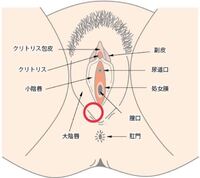 2 3週間前くらいから大陰唇 というところに エアガンの玉くらいのしこ Yahoo 知恵袋