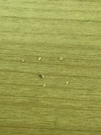 頭を掻いたらこのようなものが爪に引っかかってたんですけどこれって Yahoo 知恵袋