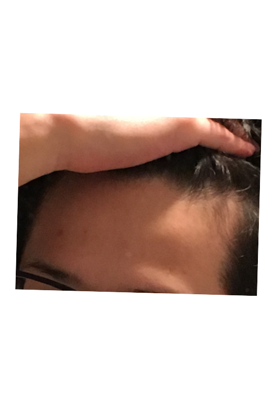 薄毛 抜け毛 解決済みの質問 Yahoo 知恵袋