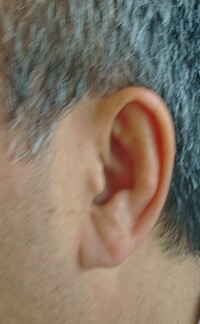 最近ｓｎｓ等で話題になっています 耳のしわ に関するご質問です 左側の耳に Yahoo 知恵袋