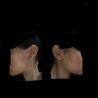 写真汚くてすみません 耳の位置が後ろの方な気がします治し方 Yahoo 知恵袋