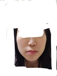 顔面が左右非対称すぎてコンプレックスです 画像参照 歪みを解消する Yahoo 知恵袋