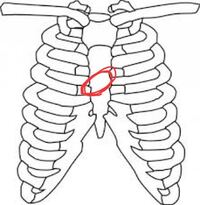 胸と胸の間にあるの骨あたりがズキズキして痛いのですが どうし Yahoo 知恵袋