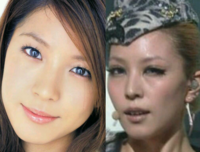 韓国芸能人整形 自らカミングアウトした人を教えてください Yahoo 知恵袋