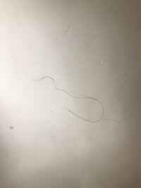 ギザギザの髪がある いったい何ですか これ 気持ち悪いです 何が原因です Yahoo 知恵袋