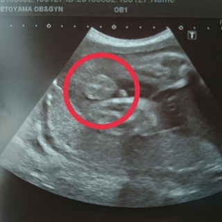 30wの妊婦です 先日の検診でお股のエコー写真をもらったのですが 先生に Yahoo 知恵袋