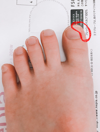 足の親指が片方だけしびれ のような違和感がありますこんにちは２１歳女 Yahoo 知恵袋