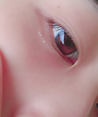 いろいろ 白い ポツポツ 白い ポツポツ 腕