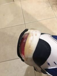 消しゴムを食べてしまいました どうすればいいですか この間スパ Yahoo 知恵袋