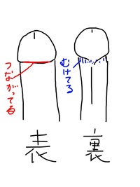 自分は勃ったときのちんこが図のような状態なのですが これは包茎で Yahoo 知恵袋
