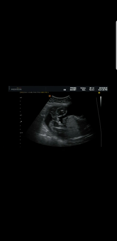 妊娠7ヶ月 男の子 に関するq A Yahoo 知恵袋