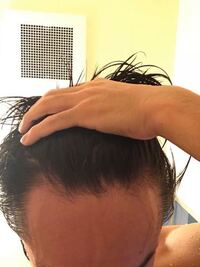 これはハゲてきてますかね 元から額は大きいのですが 最近m字にな Yahoo 知恵袋