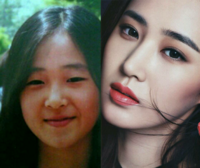 やはりk Popアイドルで一番需要が高いのは目頭切開 二重瞼施術ですか Yahoo 知恵袋