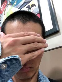 生え際が元々左右対称ではありません 左の方が薄いです これはハゲですか Yahoo 知恵袋