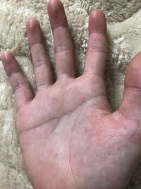 30歳 女です 手相占いわかる方 これは 俵紋とソロモン線でしょうか さらに Yahoo 知恵袋