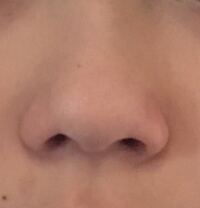 鼻の穴が左右非対称なのですが どちらが正しい形なのでしょうか また I Yahoo 知恵袋