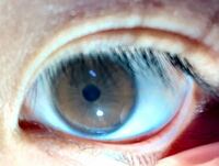 目の写真です グロ注意です この目の虹彩 パーソナルカラー Yahoo 知恵袋