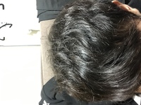天然パーマの女の子を持つお母さん 小６の娘は典型的な天然パーマで Yahoo 知恵袋