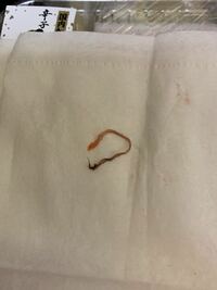 これは寄生虫ですか 昨日スーパーで買った明太子の中に写真の Yahoo 知恵袋