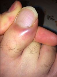 これなんだと思いますか 2週間以上前からです 爪の根元あた Yahoo 知恵袋