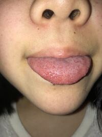 この画像は広瀬すずさんのドアップ画像です 鼻の穴の中に黒いものが見えます Yahoo 知恵袋