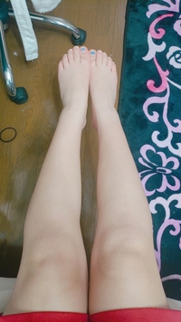 高校1年の女子です ふくらはぎが太すぎて困っています こんな太い Yahoo 知恵袋